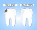 The concept of healthy and diseased tooth